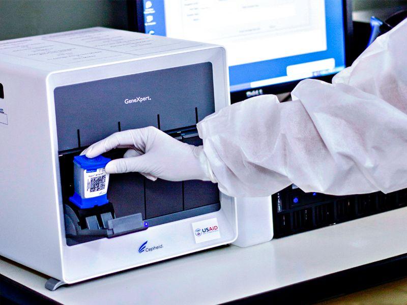 Teste rápido molecular para tuberculose é incorporado ao SUS